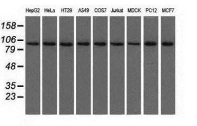 Western Blot: Isopeptidase T/USP5 Antibody (OTI2E3)Azide and BSA Free [NBP2-71355]