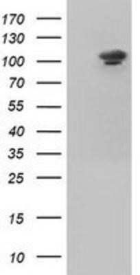 Western Blot: Isopeptidase T/USP5 Antibody (OTI2E3)Azide and BSA Free [NBP2-71355]