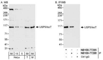 Western Blot: Isopeptidase T/USP5 Antibody [NB100-77285]