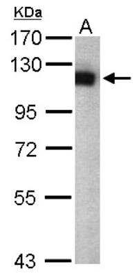 Western Blot: Isopeptidase T/USP5 Antibody [NBP1-32590]