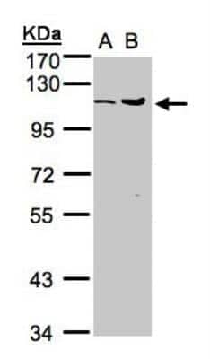 Western Blot: Isopeptidase T/USP5 Antibody [NBP1-32590]