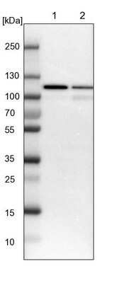 Western Blot: Isopeptidase T/USP5 Antibody [NBP1-83089]