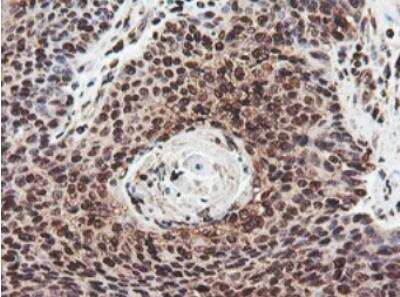 Immunohistochemistry-Paraffin: JAB1 Antibody (OTI2B12) [NBP2-01813]