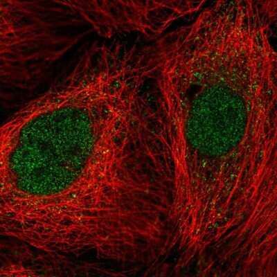 Immunocytochemistry/ Immunofluorescence: JAB1 Antibody [NBP2-55578]