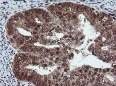 Immunohistochemistry: JAB1 Antibody (OTI2B12) - Azide and BSA Free [NBP2-71659]