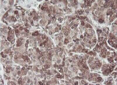 Immunohistochemistry: JAB1 Antibody (OTI2B12) - Azide and BSA Free [NBP2-71659]