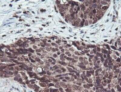 Immunohistochemistry: JAB1 Antibody (OTI2B12) - Azide and BSA Free [NBP2-71659]