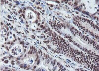 Immunohistochemistry: JAB1 Antibody (OTI2B12) - Azide and BSA Free [NBP2-71659]