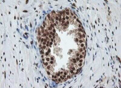 Immunohistochemistry: JAB1 Antibody (OTI2B12) - Azide and BSA Free [NBP2-71659]