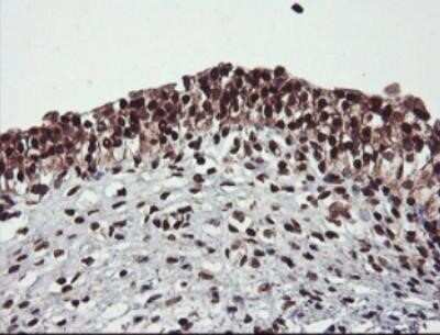 Immunohistochemistry: JAB1 Antibody (OTI2B12) - Azide and BSA Free [NBP2-71659]