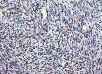 Immunohistochemistry: JAB1 Antibody (OTI2B12) - Azide and BSA Free [NBP2-71659]