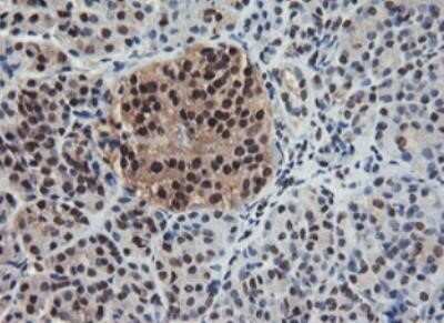 Immunohistochemistry: JAB1 Antibody (OTI2B12) - Azide and BSA Free [NBP2-71659]