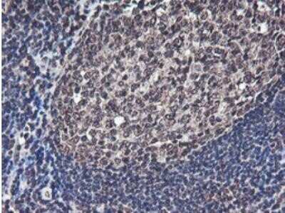 Immunohistochemistry: JAB1 Antibody (OTI2B12) - Azide and BSA Free [NBP2-71659]