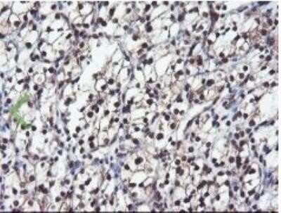 Immunohistochemistry: JAB1 Antibody (OTI2B12) - Azide and BSA Free [NBP2-71659]
