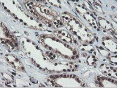 Immunohistochemistry-Paraffin: JAB1 Antibody (OTI2B12) [NBP2-01813]