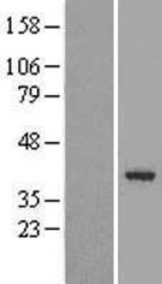 Western Blot: JAB1 Overexpression Lysate [NBL1-09383]