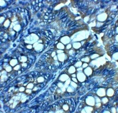 Immunohistochemistry: JAGN1 Antibody - BSA Free [NBP2-81910]