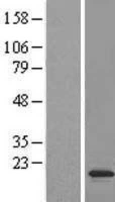 Western Blot: JAGN1 Overexpression Lysate [NBL1-12092]