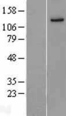 Western Blot: Jak1 Overexpression Lysate [NBL1-12093]