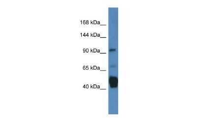 Western Blot: JAKMIP2 Antibody [NBP2-87641]