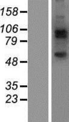 Western Blot: JAKMIP2 Overexpression Lysate [NBP2-07269]