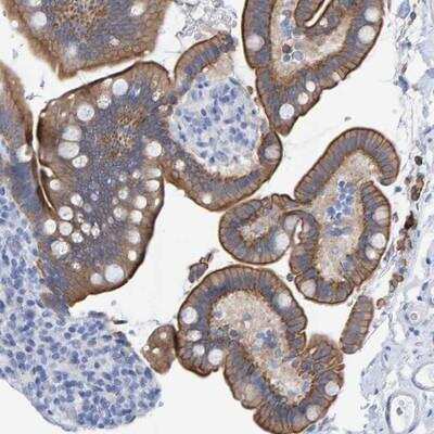 Immunohistochemistry-Paraffin: JAKMIP3 Antibody [NBP1-90835]