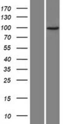 Western Blot: JAKMIP3 Overexpression Lysate [NBP2-09357]