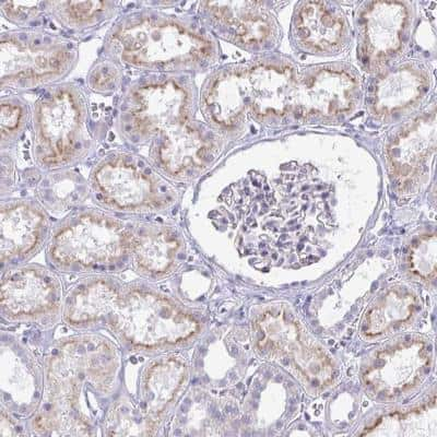 Immunohistochemistry-Paraffin: JAM-4/IGSF5 Antibody [NBP2-34155]