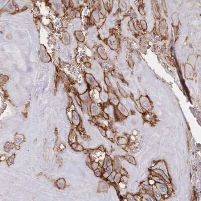 Immunohistochemistry-Paraffin: JAM-A Antibody [NBP2-38934]