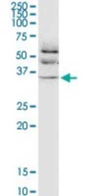 Western Blot: JAM-B/VE-JAM Antibody (1G4) [H00058494-M01]