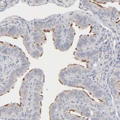 Immunohistochemistry-Paraffin: JAM-C Antibody [NBP1-92032]