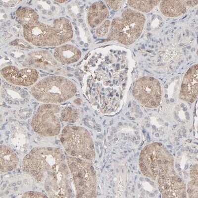 Immunohistochemistry-Paraffin: JAM-C Antibody [NBP1-92032]
