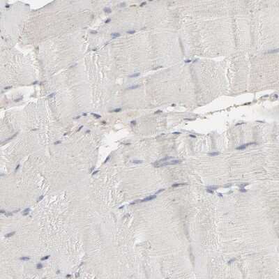 Immunohistochemistry-Paraffin: JAM-C Antibody [NBP1-92032]