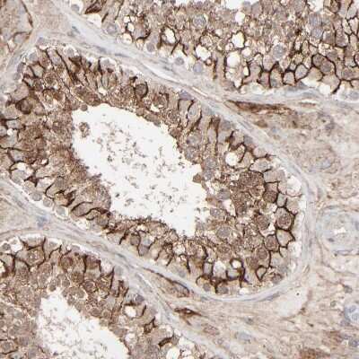 Immunohistochemistry-Paraffin: JAM-C Antibody [NBP1-92032]