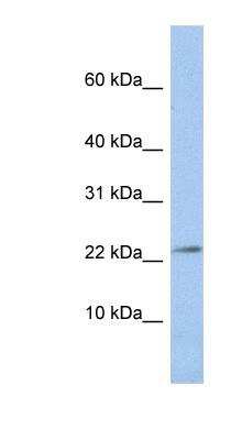 Western Blot: JAM-C Antibody [NBP1-60096]