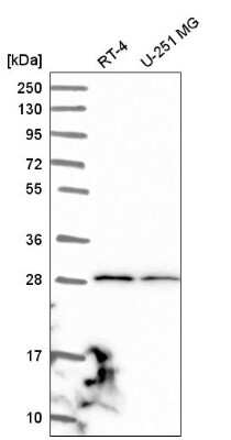 Western Blot: JAM-C Antibody [NBP2-58727]