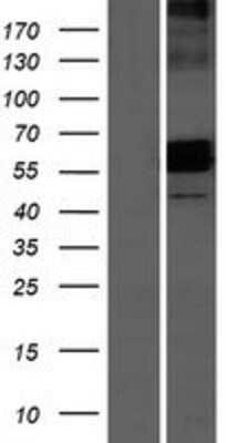 Western Blot: AMICA/JAML Overexpression Lysate [NBP2-10922]