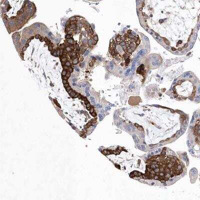 Immunohistochemistry: JAMP Antibody [NBP1-89906]