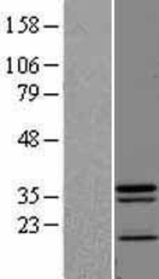 Western Blot: JAMP Overexpression Lysate [NBL1-08167]