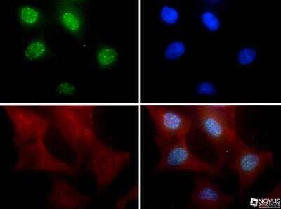 Immunocytochemistry/ Immunofluorescence: Lysine (K)-specific Demethylase 5B/KDM5B/JARID1B Antibody - BSA Free [NBP1-97310]