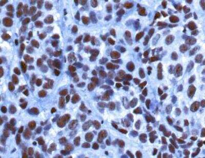 Immunohistochemistry: Lysine (K)-specific Demethylase 5B/KDM5B/JARID1B Antibody - BSA Free [NBP1-97310]
