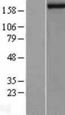 Western Blot: Lysine (K)-specific Demethylase 5B/KDM5B/JARID1B Overexpression Lysate [NBL1-12099]