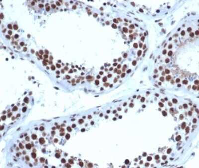 Immunohistochemistry-Paraffin: JAZF1 Antibody (PCRP-JAZF1-1C2) [NBP3-13885]