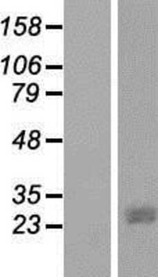 Western Blot: JAZF1 Overexpression Lysate [NBP2-05075]