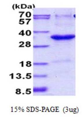 SDS-PAGE: Recombinant Human JAZF1 His Protein [NBP2-23155]