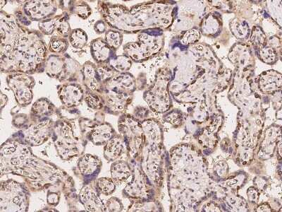 Immunohistochemistry: JCAD Antibody [NBP2-98089]