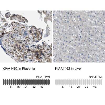 Immunohistochemistry-Paraffin: JCAD Antibody [NBP1-90941]