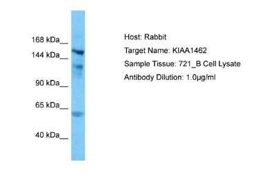 Western Blot: JCAD Antibody [NBP2-83094]