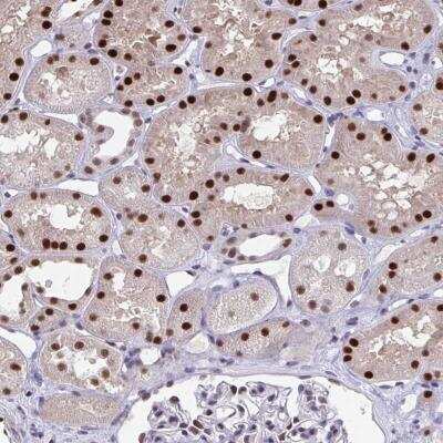 Immunohistochemistry-Paraffin: JDP2 Antibody [NBP2-31775]