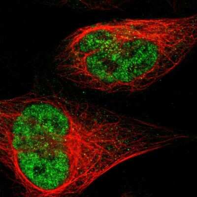 Immunocytochemistry/ Immunofluorescence: JHDM1D Antibody [NBP1-81382]